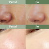 Płyn oczyszczający pory (Premium Quick Step Sebum Cleanser) Dr. Althea