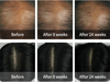 Szampon przeciw wypadaniu włosów 50 ml (Dermatical Hair-Loss Shampoo) La'dor